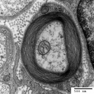 Cross-section of a myelinated neuron.