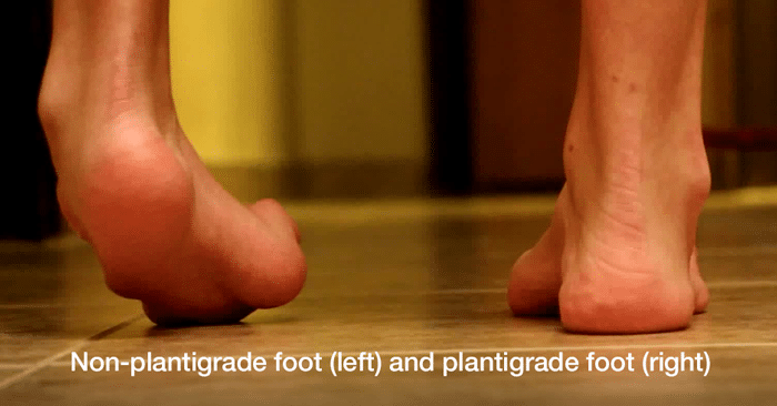 Plantigrade Foot