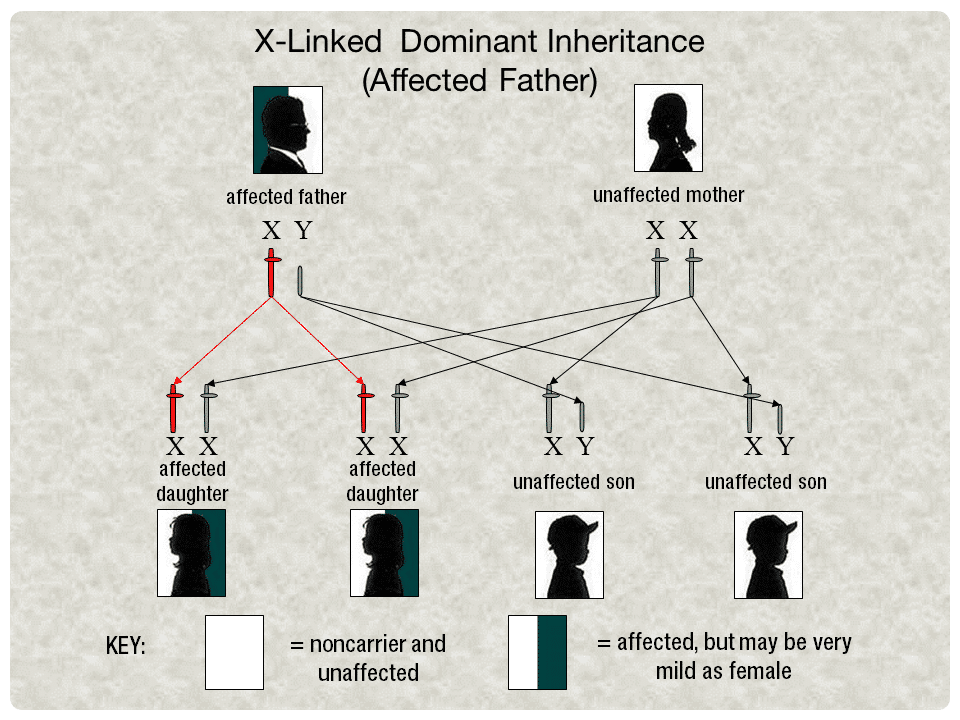 X-Linked Dominant Inheritance - Affected Father