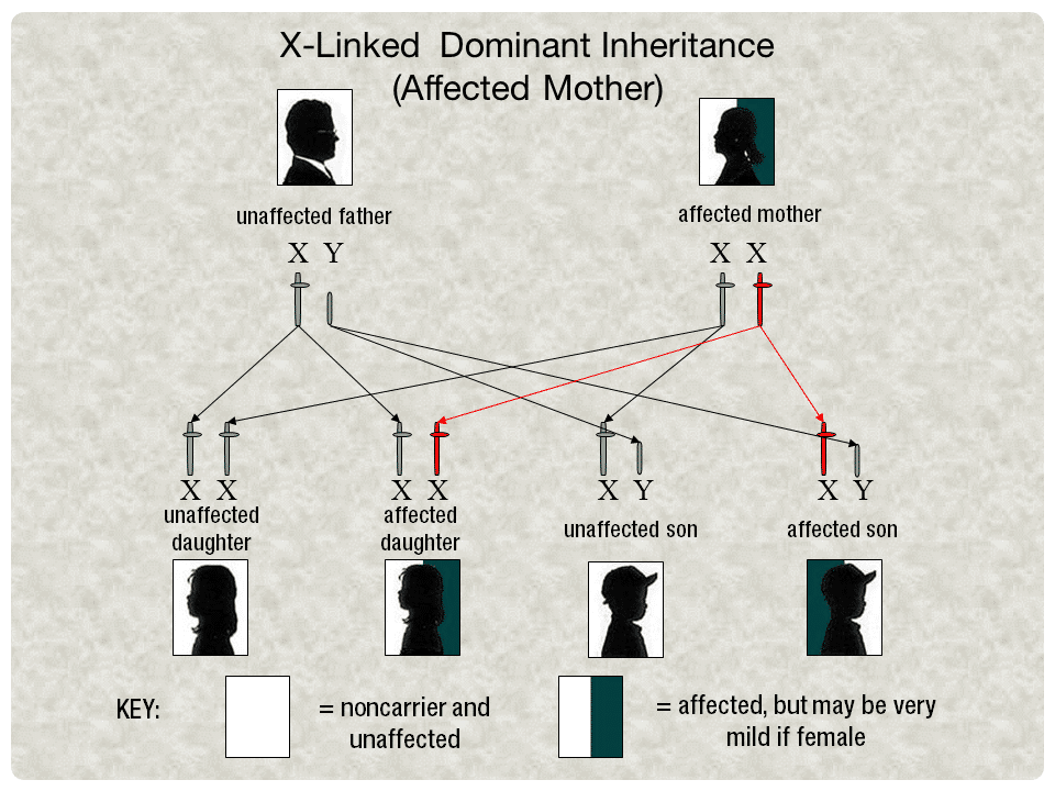 X-Linked Dominant Inheritance - Affected Mother