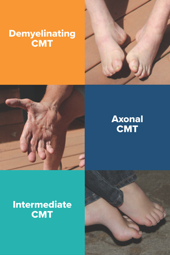 Three Forms of CMT