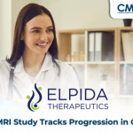 What If We Could Measure CMT4J Getting Worse Before It Feels Worse?